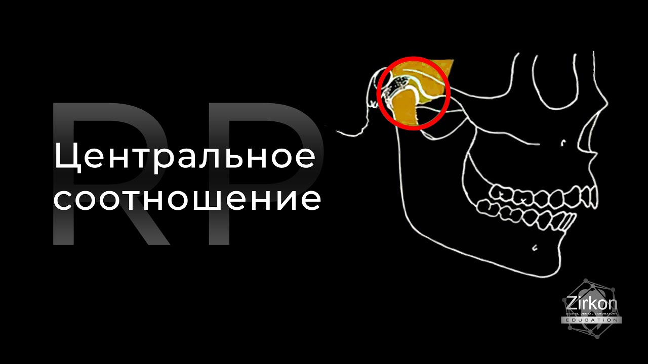 Центральное соотношение. Биомеханика ВНЧС. Видео для стоматологов и зубных техников от ZIRKON LAB