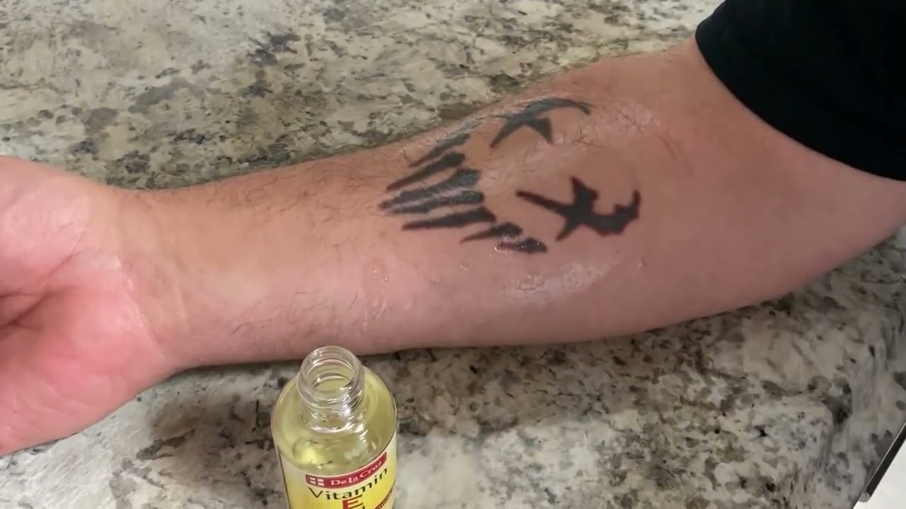 How to Properly Care for Your Tattoo After a Laser Treatment