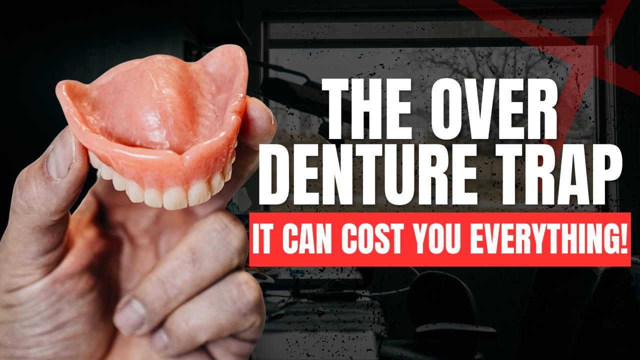 The Over Denture Trap: Why “Cheaper” Can Cost You Everything