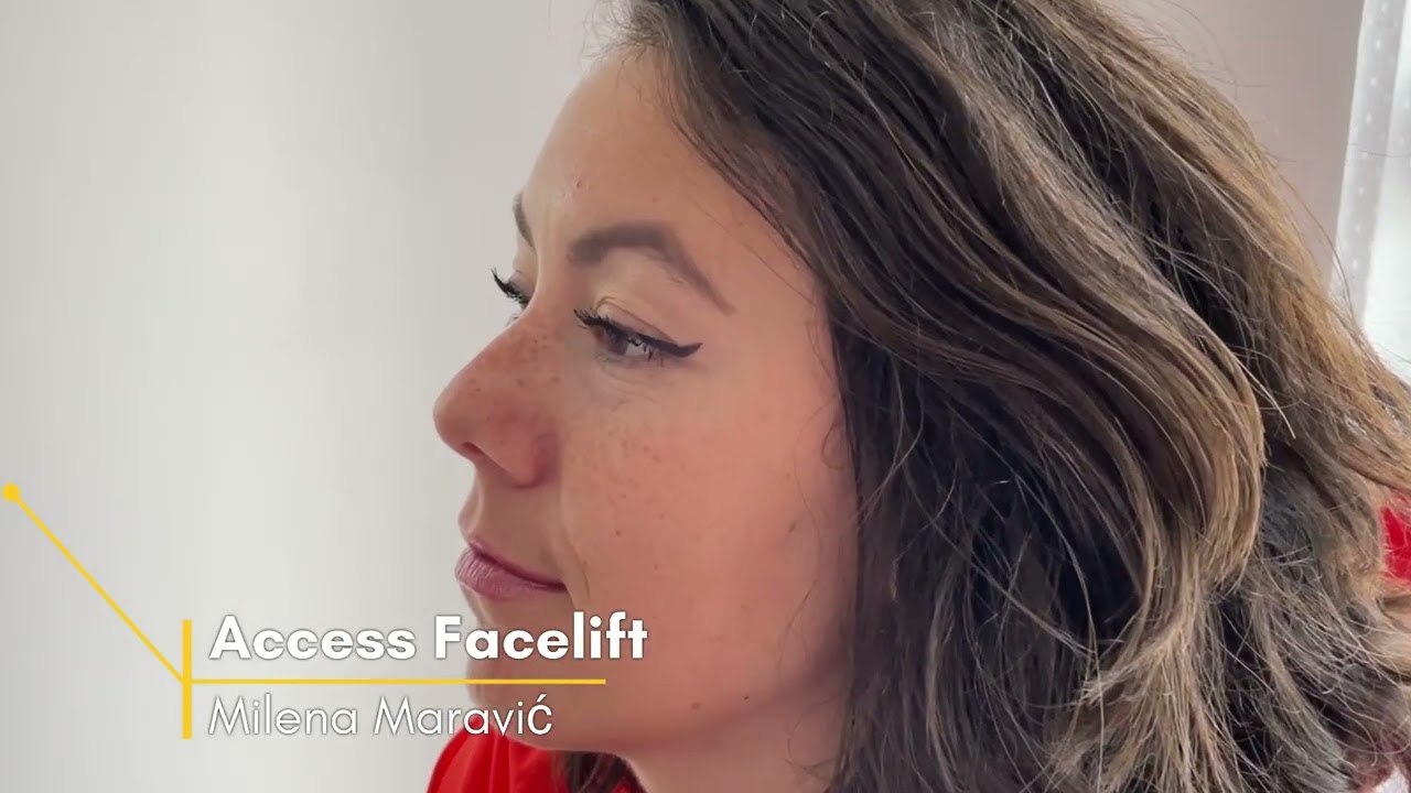 Access Facelift session