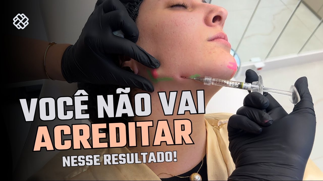 HARMONIZEI UM ROSTO JOVEM | e o resultado foi surpreendente!