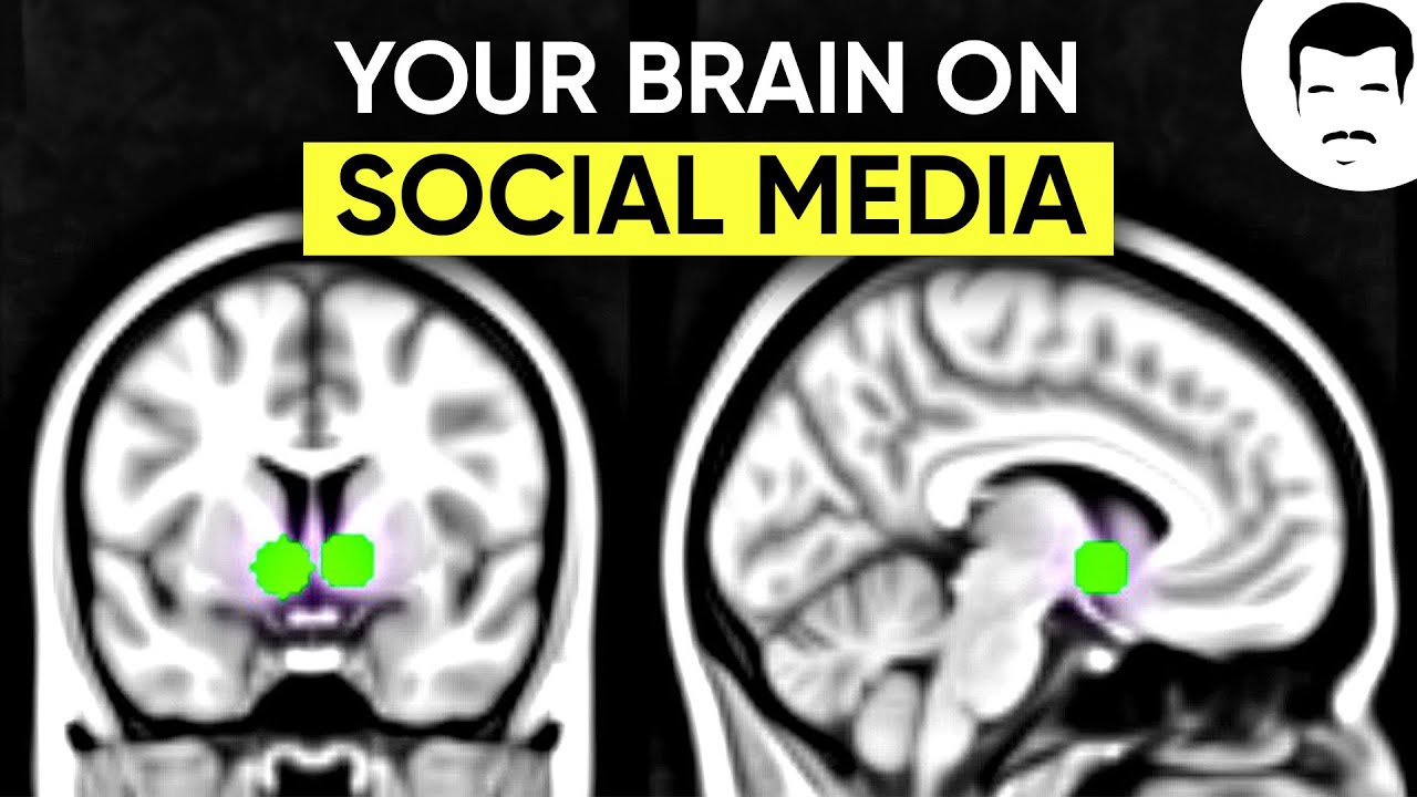 Rewiring Your Dopamine Systems with Neil deGrasse Tyson and Anna Lembke