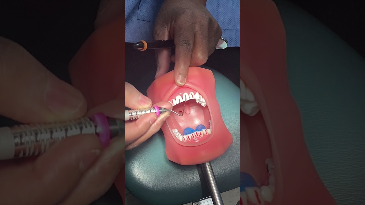 Periodontal probing
