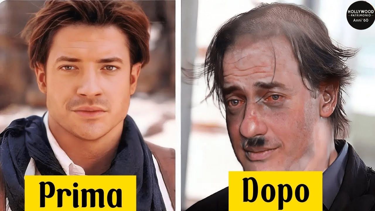 21 celebrità distrutte dalla droga  PRIMA e DOPO