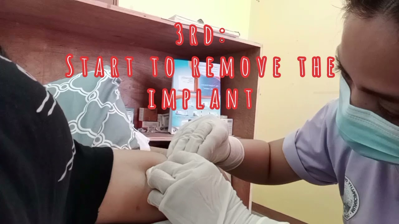 IMPLANT REMOVAL AND INSERTION