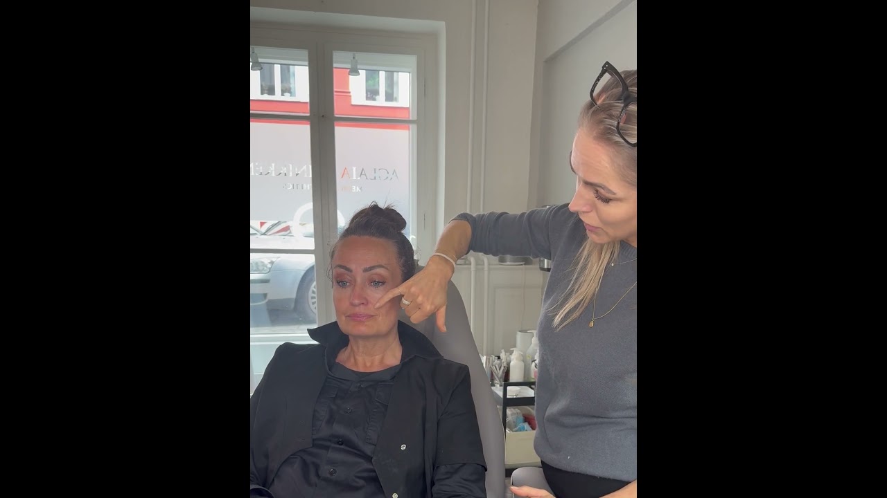 Skinbooster behandling | Trin-for-trin forklaring | Aglaia klinikken