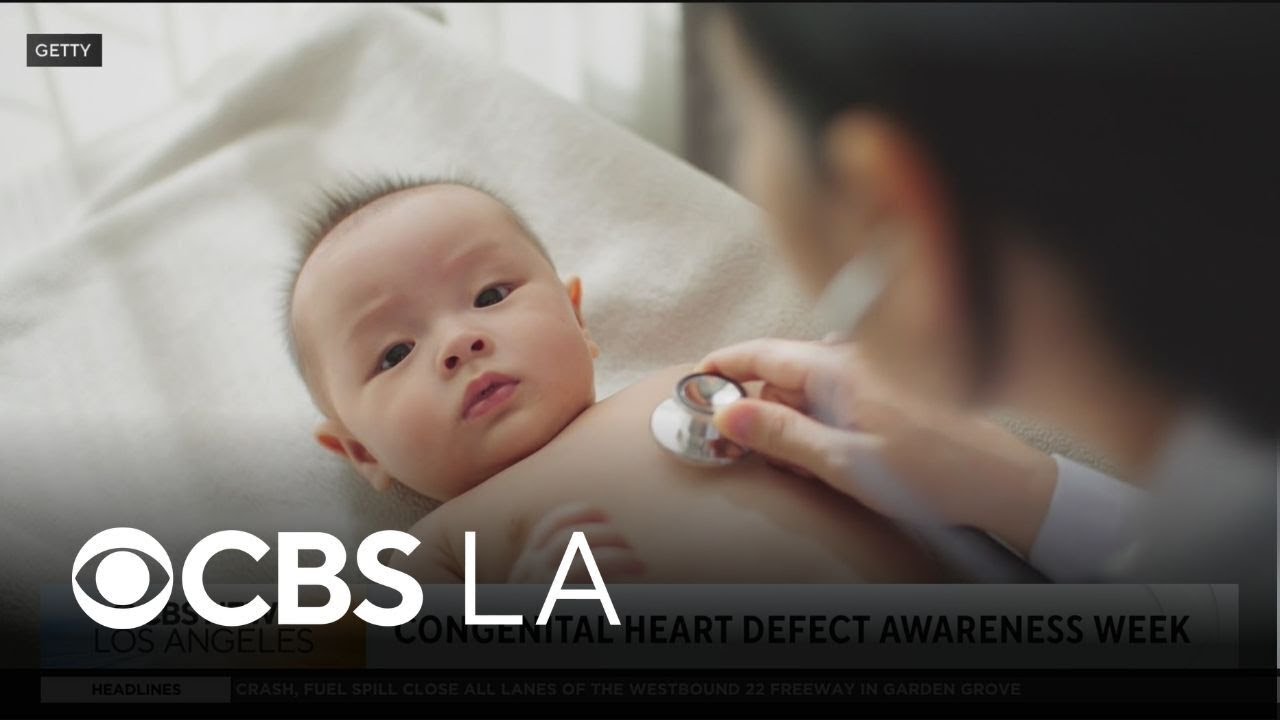 Doctor raises awareness during Congenital Heart Defect Awareness Week