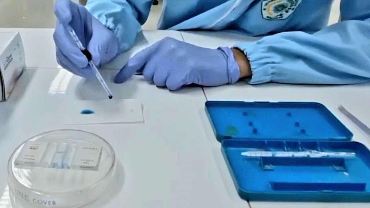 HITUNG JUMLAH TROMBOSIT (CARA LANGSUNG)