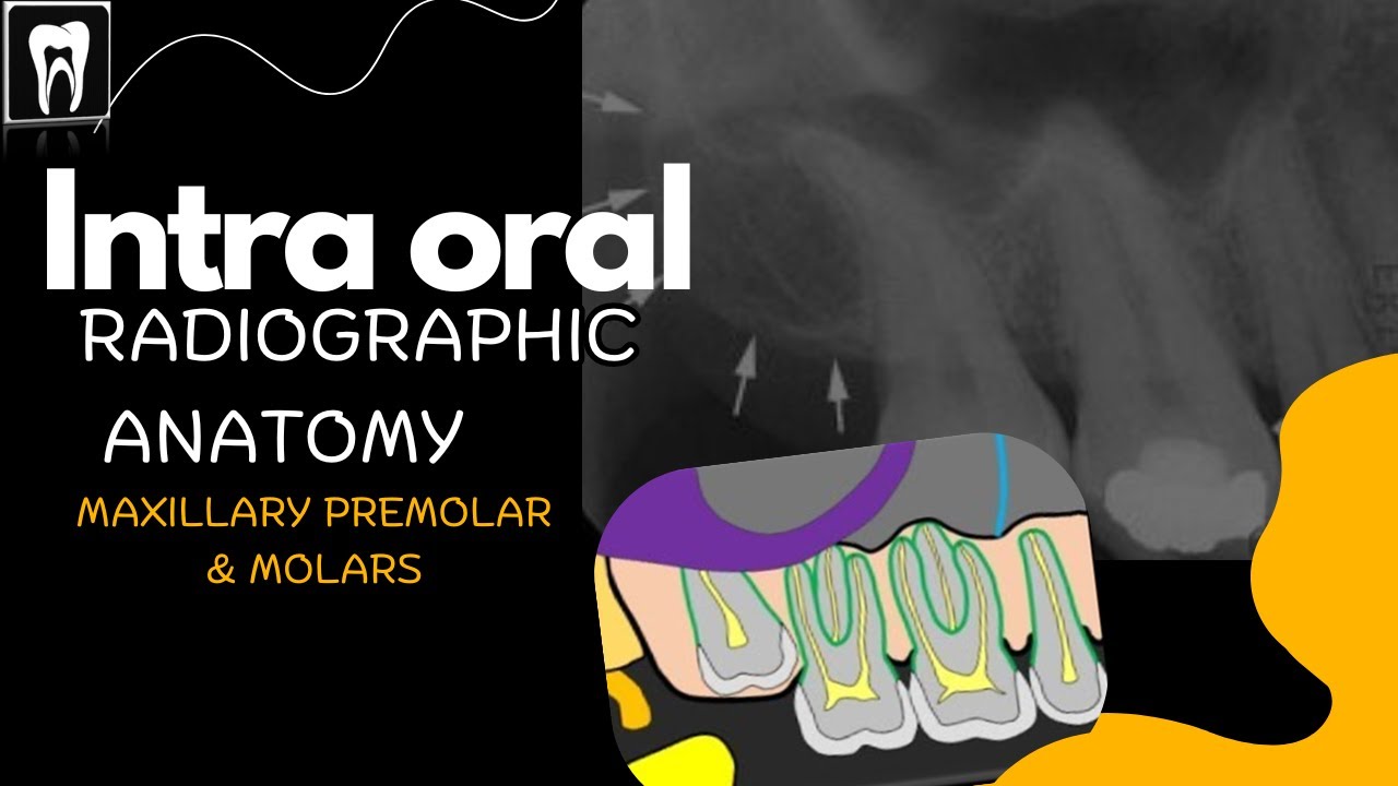 Intra Oral Anatomy/ Normal radiographic anatomical landmarks/Maxilla premolar and molar region