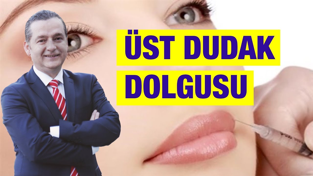 Üst Dudak Dolgusu !!