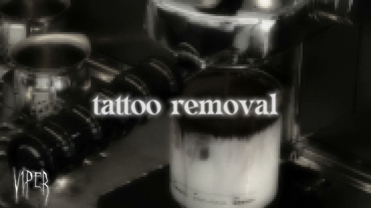 tattoo removal.