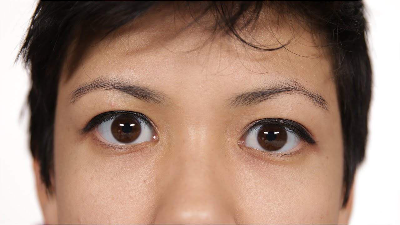 East Asians Test Double Eyelid Products