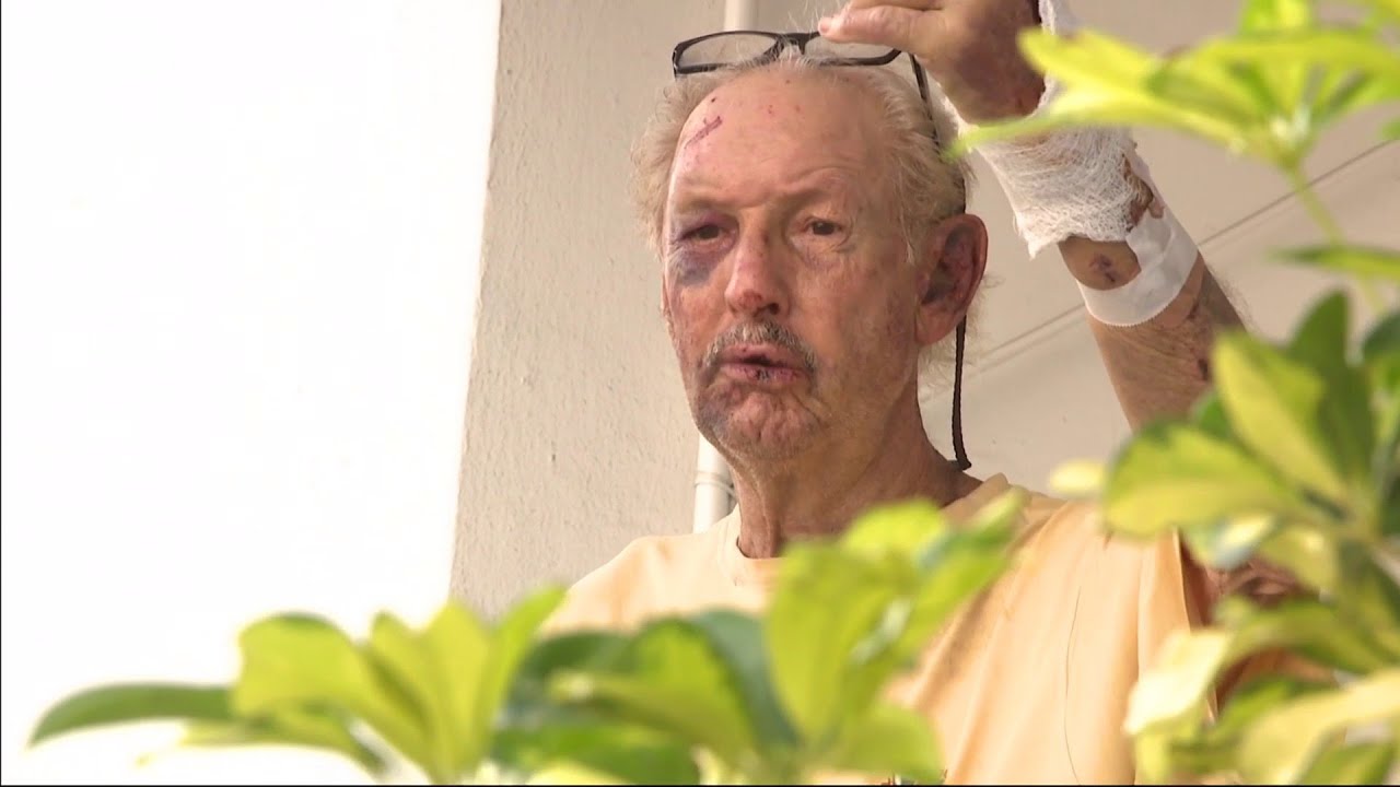 Senior speaks after brutal home-invasion beating