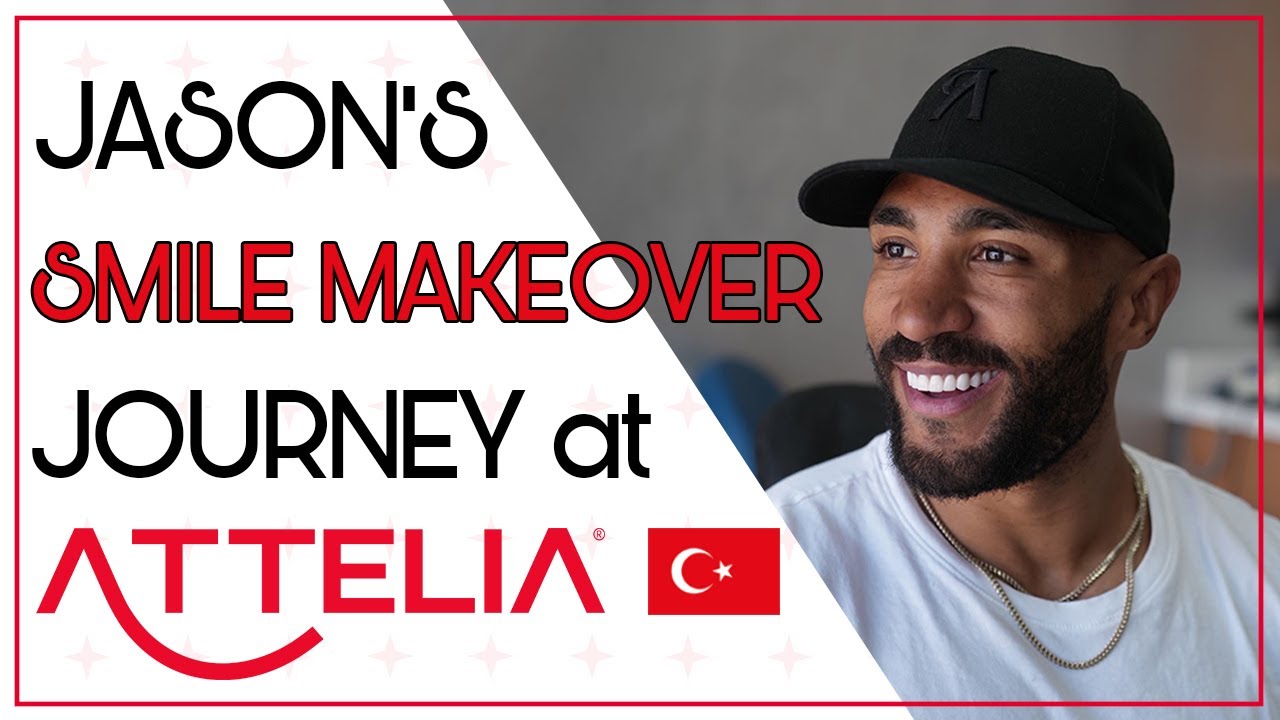 JASON'S SMILE MAKEOVER JOURNEY #attelia #milliondollarsmile