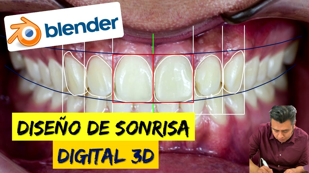 ✔ REALIZA un DISEÑO DE SONRISA 3D en BLENDER Dental Mode ✔