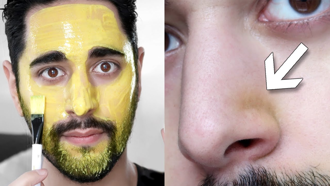 Turmeric Face Mask Benefits & First Impression - Turmeric, Honey + Natural Yoghurt ✖ James Welsh