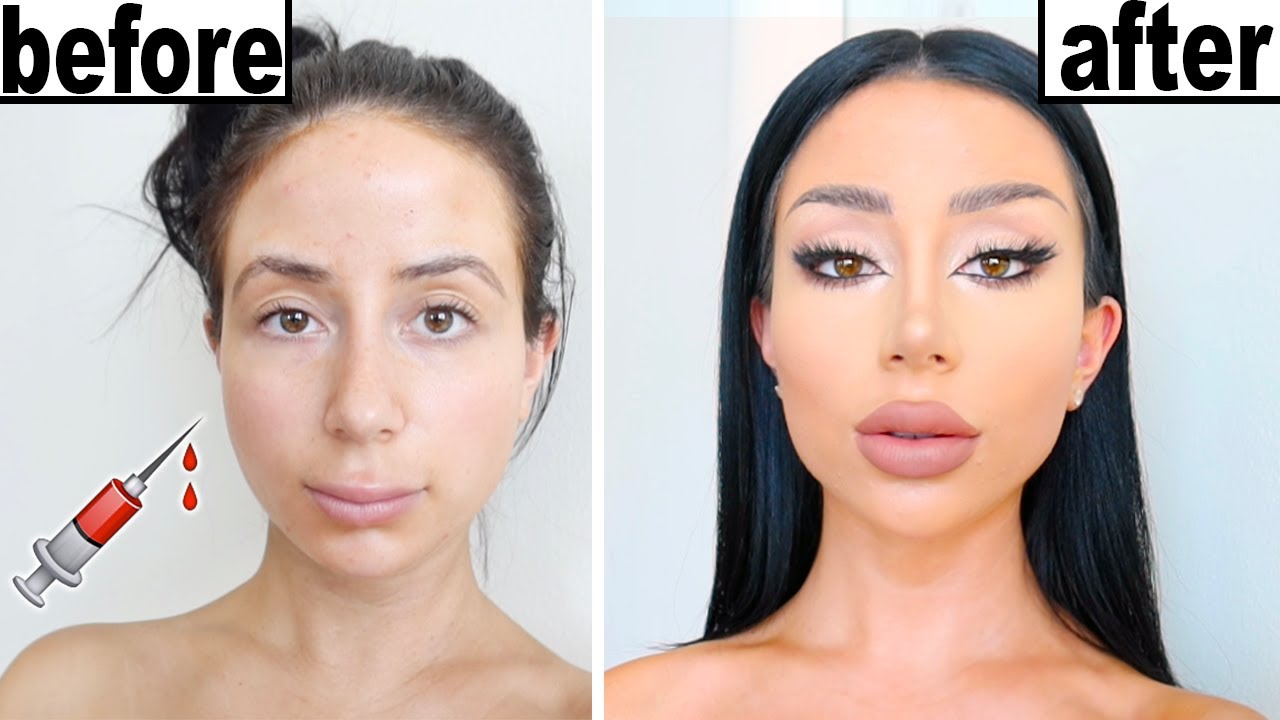 DIY PLASTIC SURGERY!