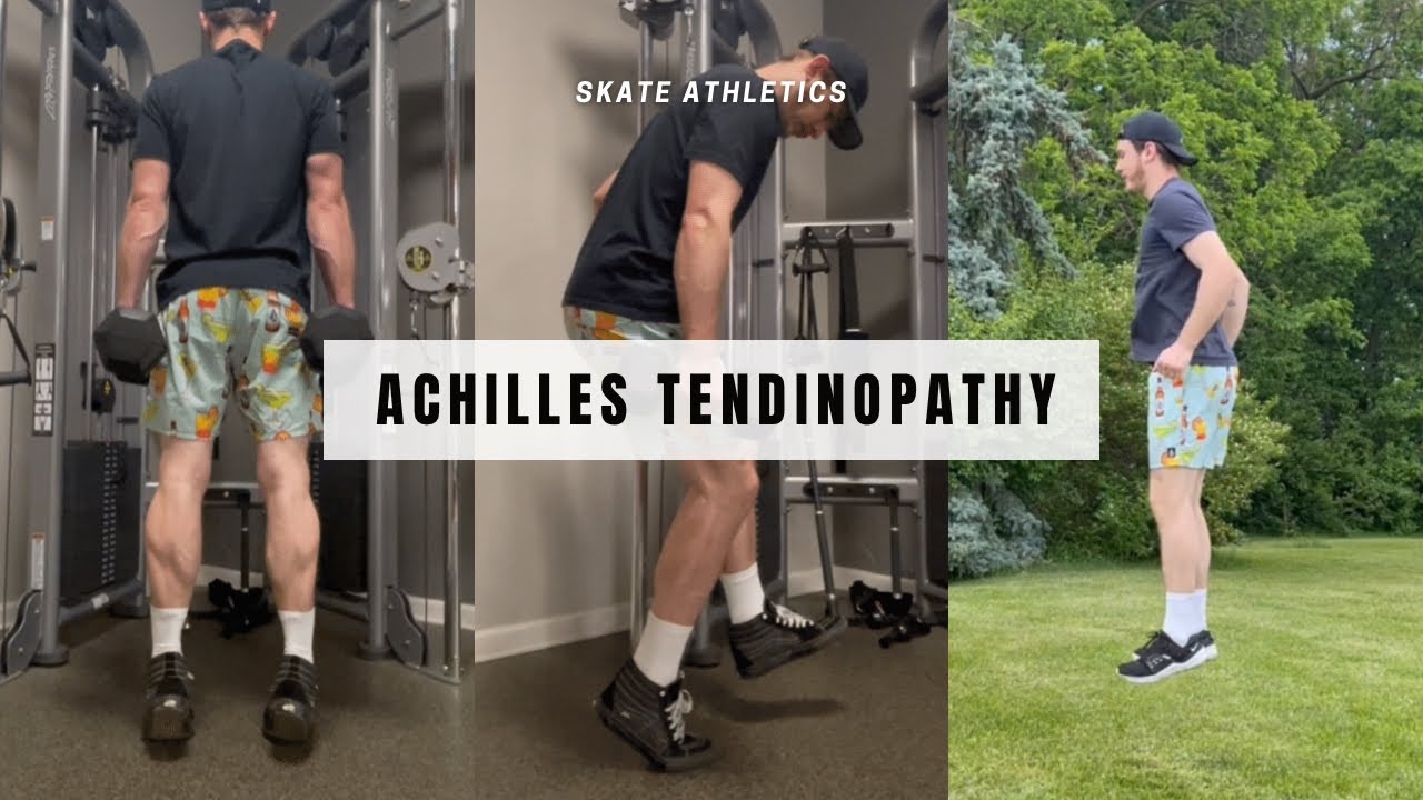 Injury Prevention for SKATEBOARDERS (Achilles Tendinopathy)