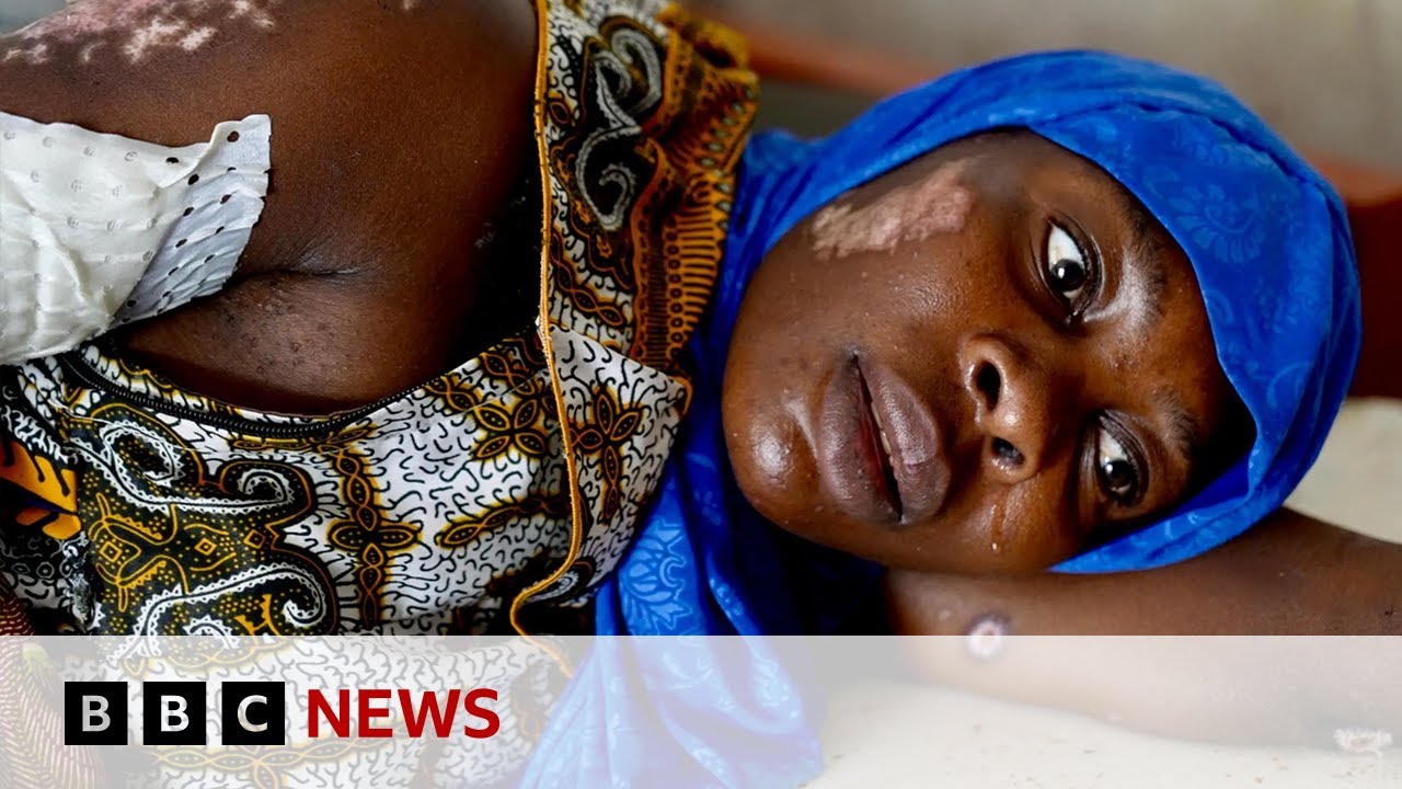 DR Congo war: Rape survivors recall horror of Goma jailbreak | BBC News