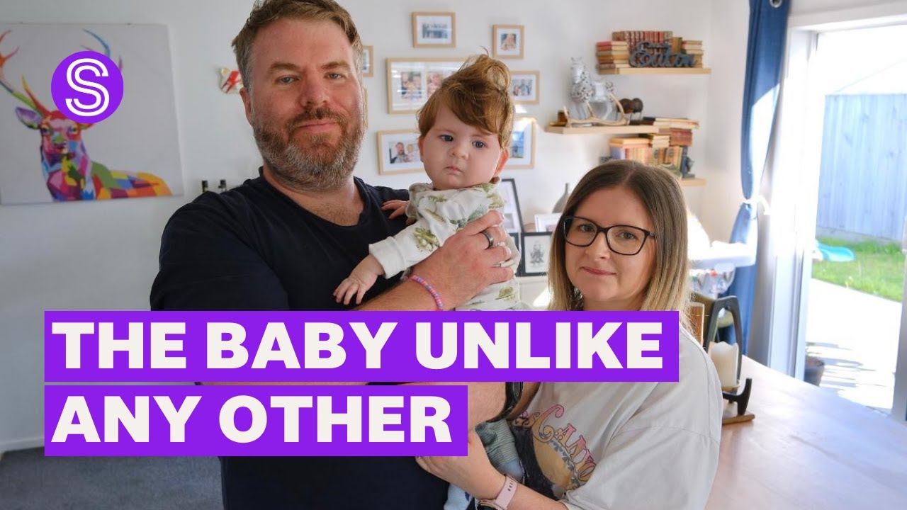 This baby has a condition so rare they may be the only one in the world to have it | Stuff.co.nz