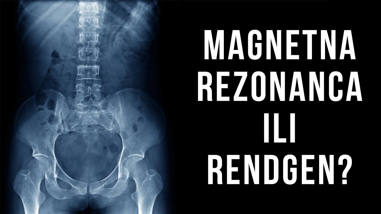 Gonstead kiropraktika - magnetna rezonanca ili rendgen?