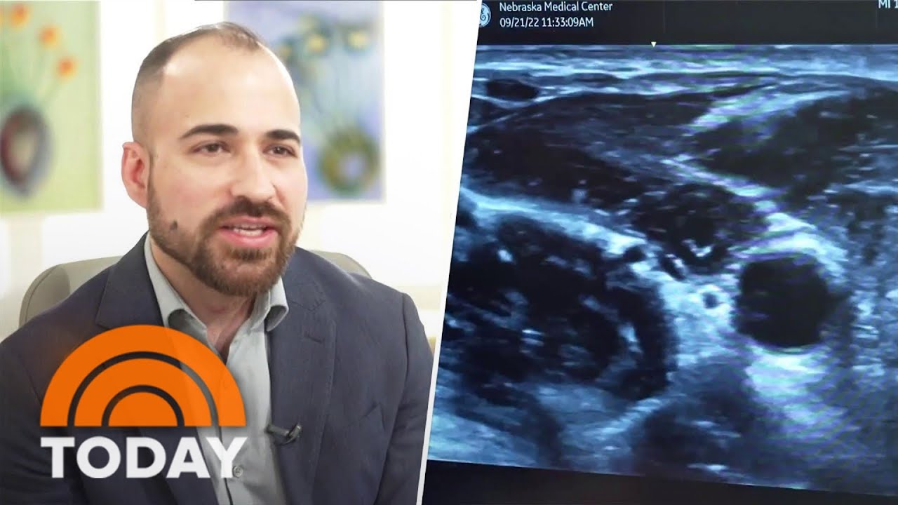 Doctor Finds Cancer In His Thyroid While Testing Ultrasound Machine
