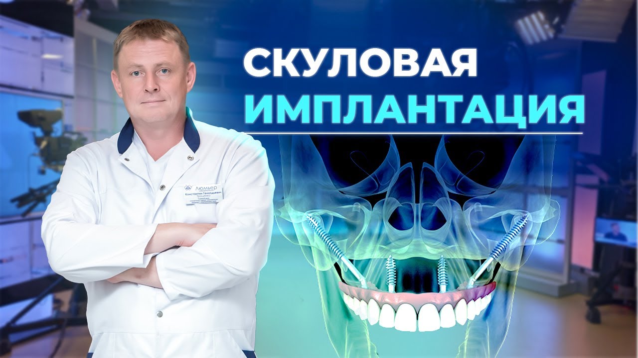 Скуловая имплантация вместо съемного протеза 💎