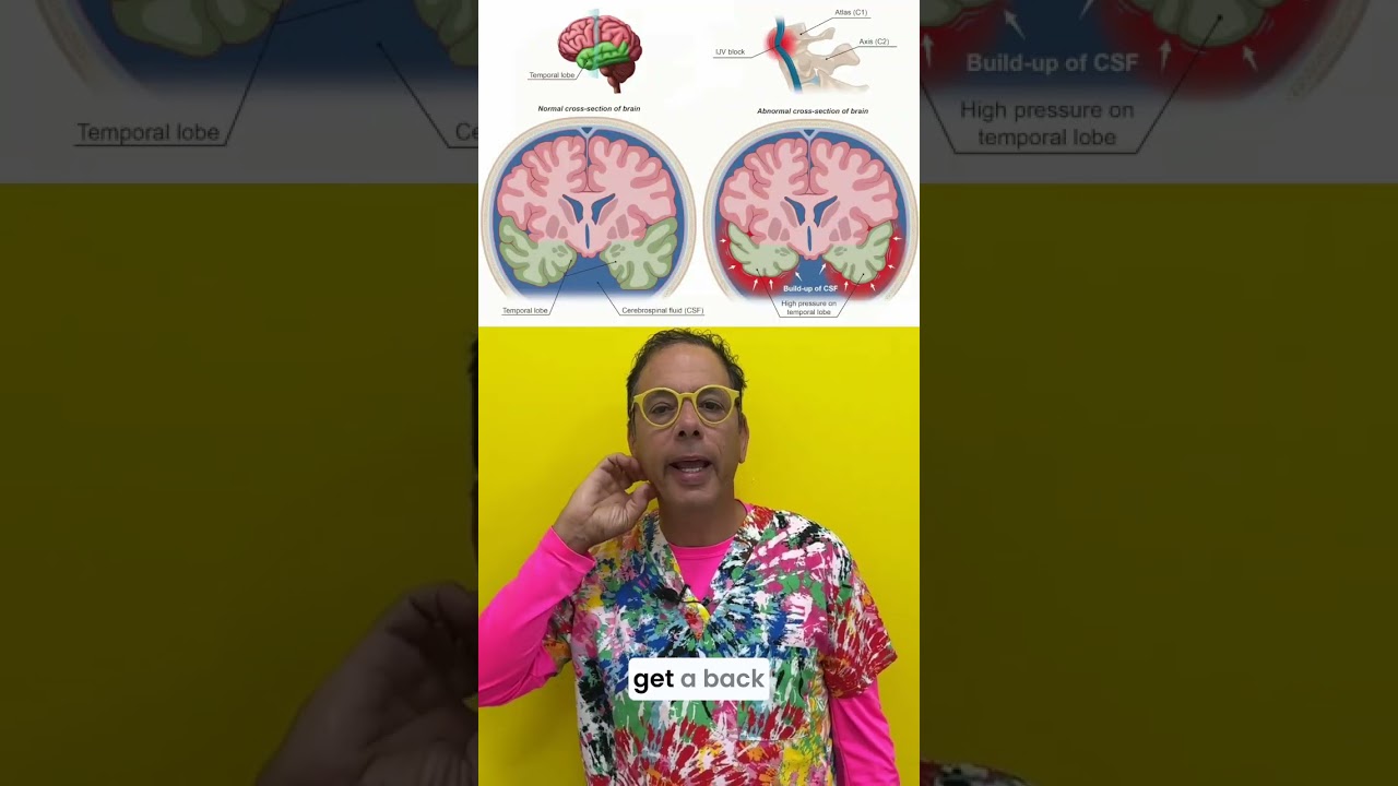 Semicircular canal dehiscence caused by cervical instability #neck #balance #vestibular #hearing