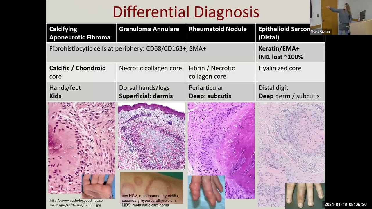 Cipriani Soft Tissue Continued 2024 01 18