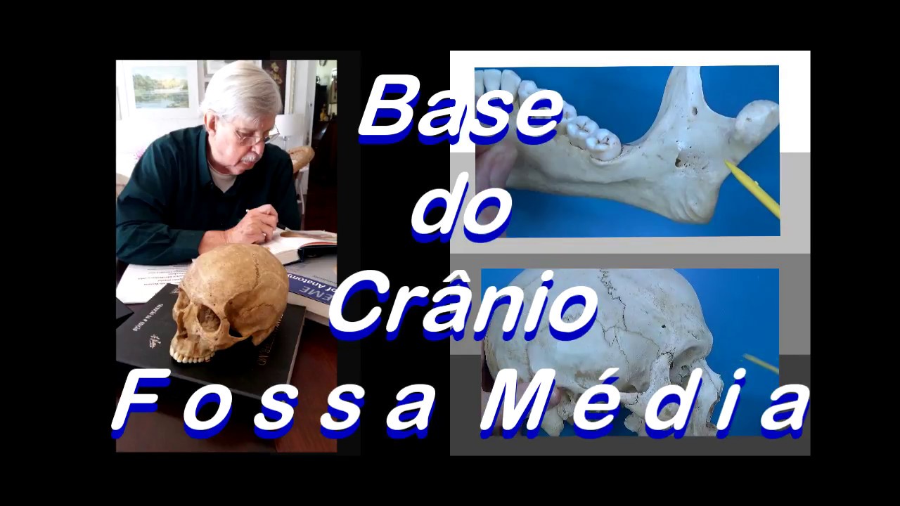 base do cranio fossa media