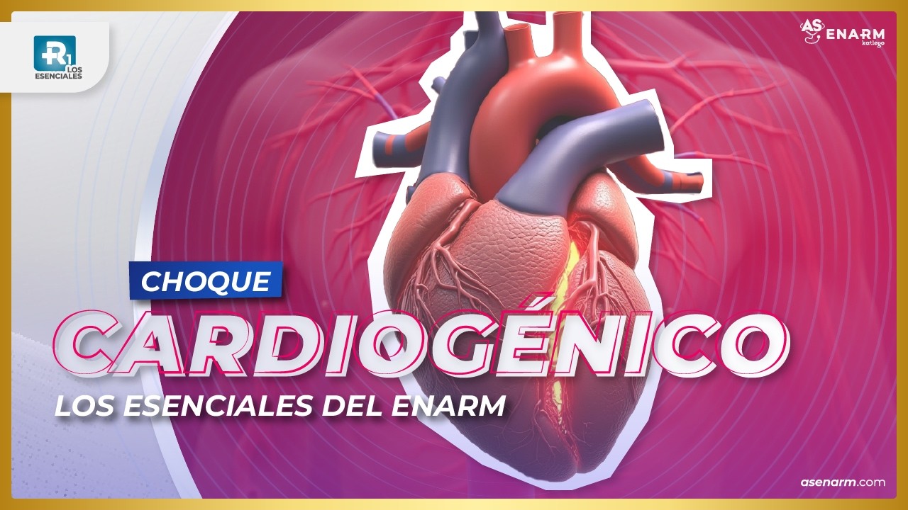 Choque Cardiogénico: Todo lo que Necesitas Saber para el ENARM