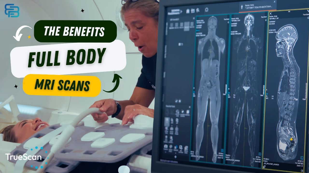 My Full Body MRI Experience: Surprising Health Benefits Revealed