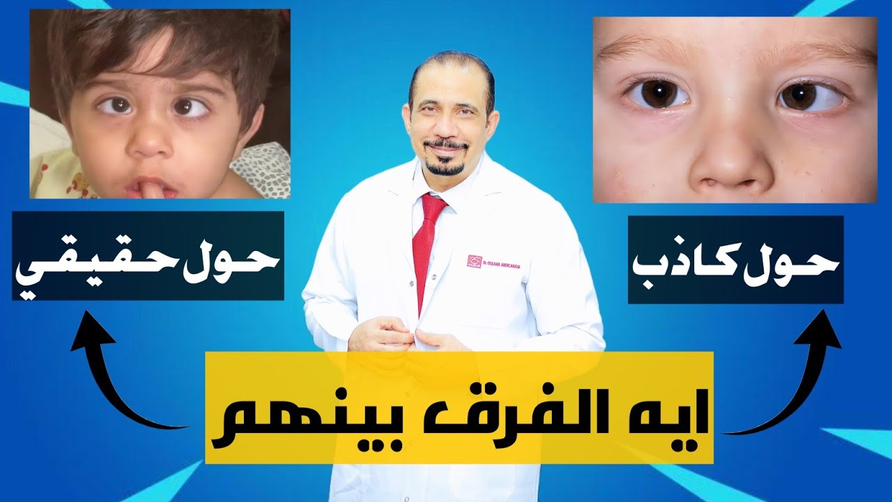 الفرق بين الحول الكاذب والحقيقي؟ 🤔🩺