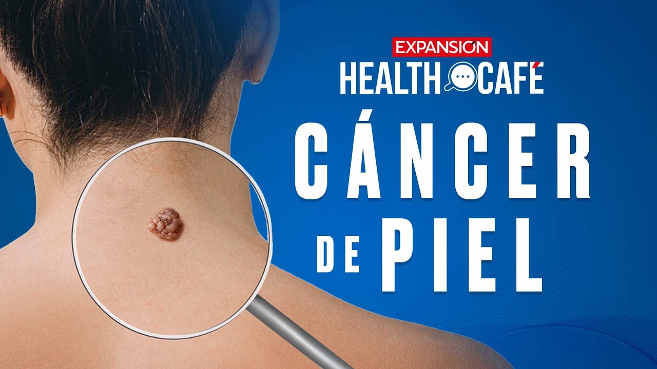 ¿Cómo IDENTIFICAR el CÁNCER de PIEL? | Ep.38 | Health Café