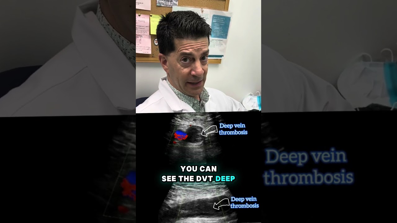 WHAT IS A DVT?