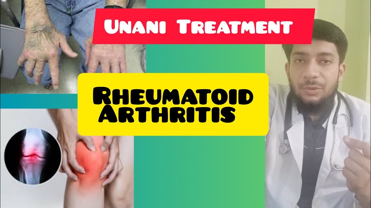 Unani Treatment of Rheumatoid Arthritis