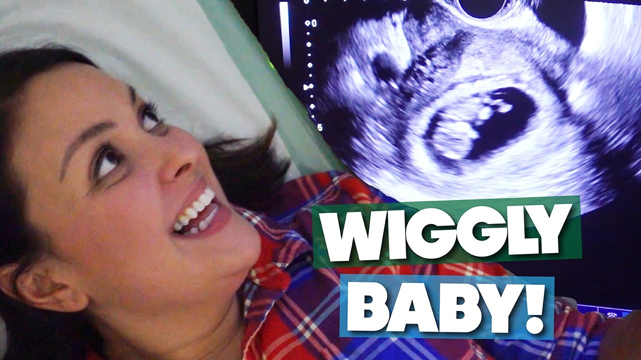 10 WEEK ULTRASOUND! BABY WIGGLING LIKE CRAZY!!!