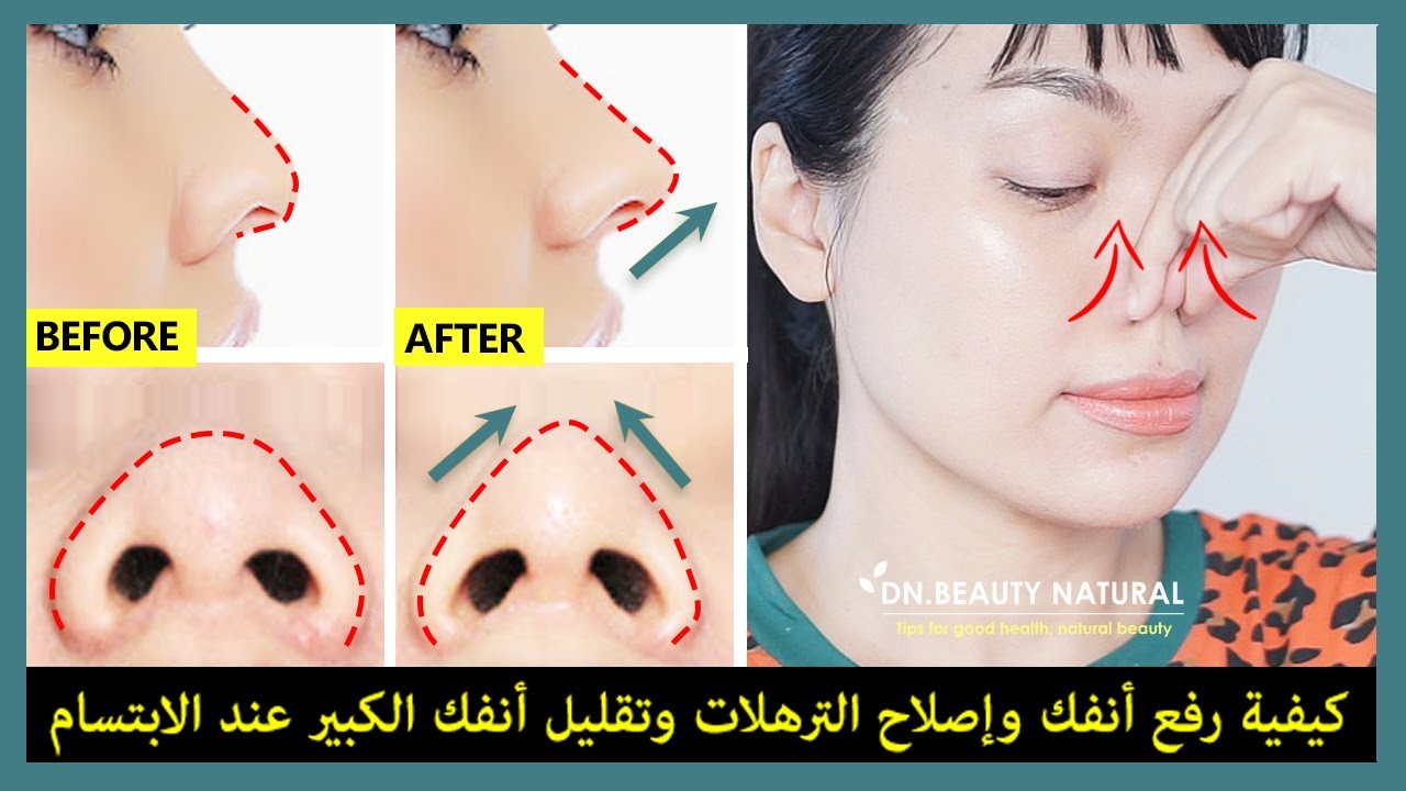 😃👃 كيف ترفع أنفك ، وإصلاح الأنف المترهل والأنف المترهل ، وتقليل الأنف الكبير عند الابتسام
