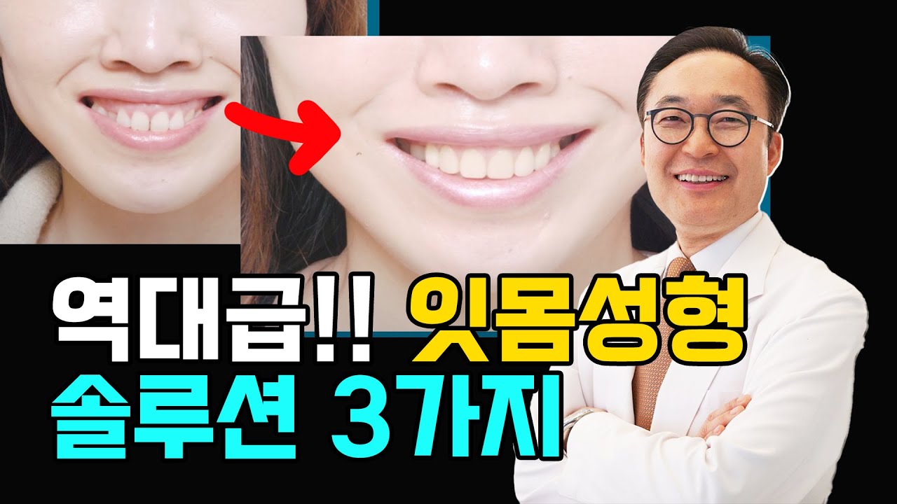 잇몸성형 이렇게 하시면 재발없이 할 수 있습니다