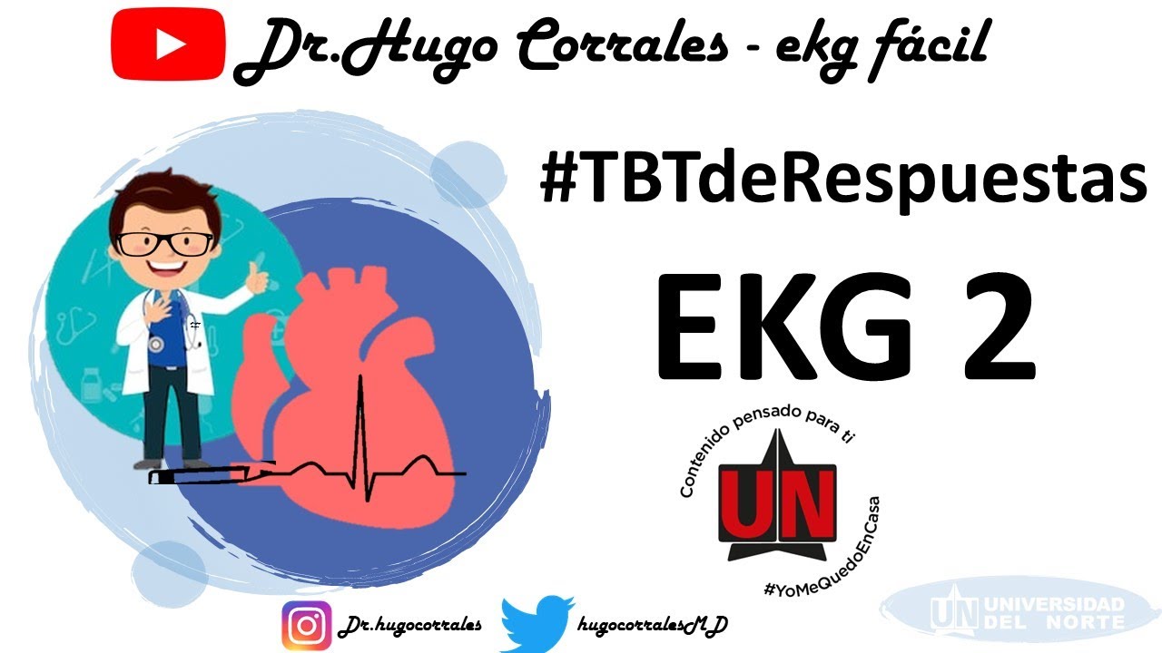 EKG ejemplo 2 #TBTdeRespuestas