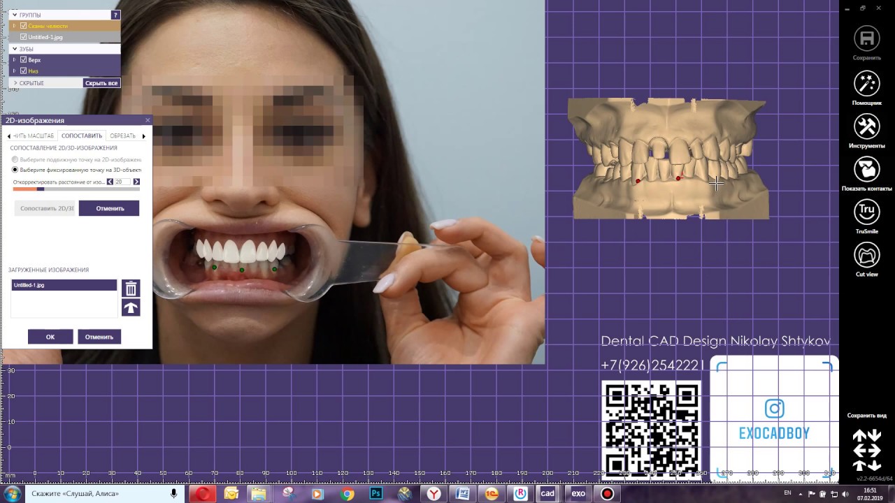 Как сделать Smiledesign в ExoCad, если нет модуля