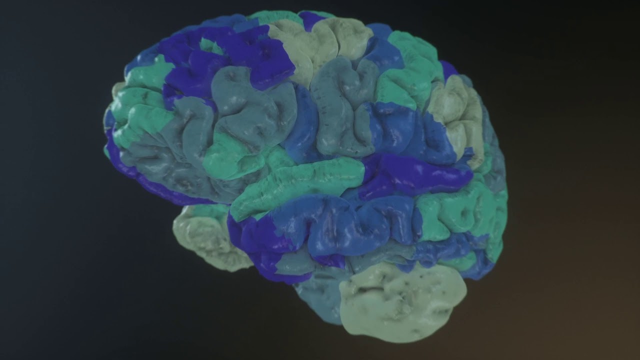 Virtual Brain Modeling for Epilepsy: The Next Generation