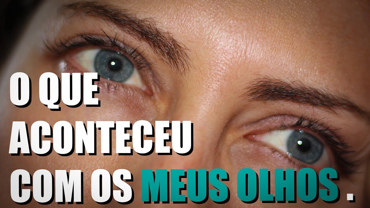 O que aconteceu com os Meus Olhos