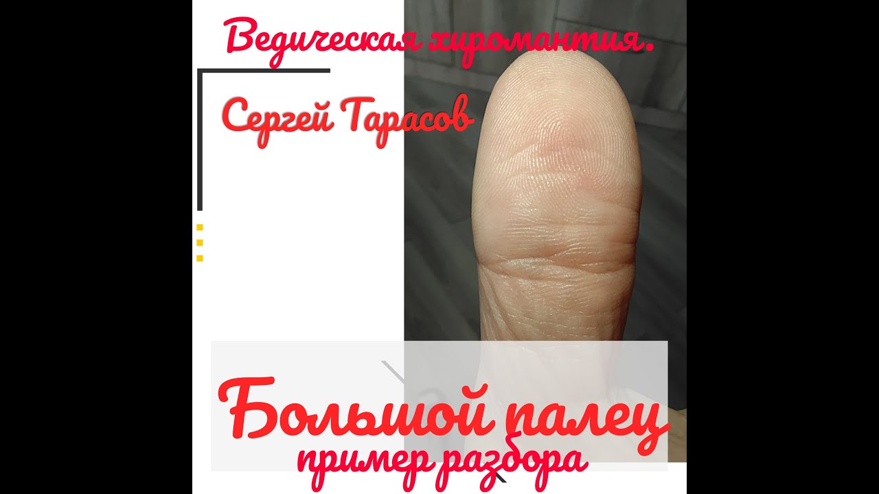 Большой палец. Пример разбора.