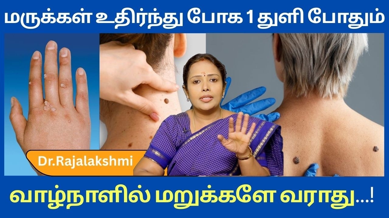 மருக்கள் உதிர்ந்து போக 1துளி போதும்!!!வாழ்நாளில் மறுக்களே வராது | ASM INFO Special |Dr.Rajalakshmi