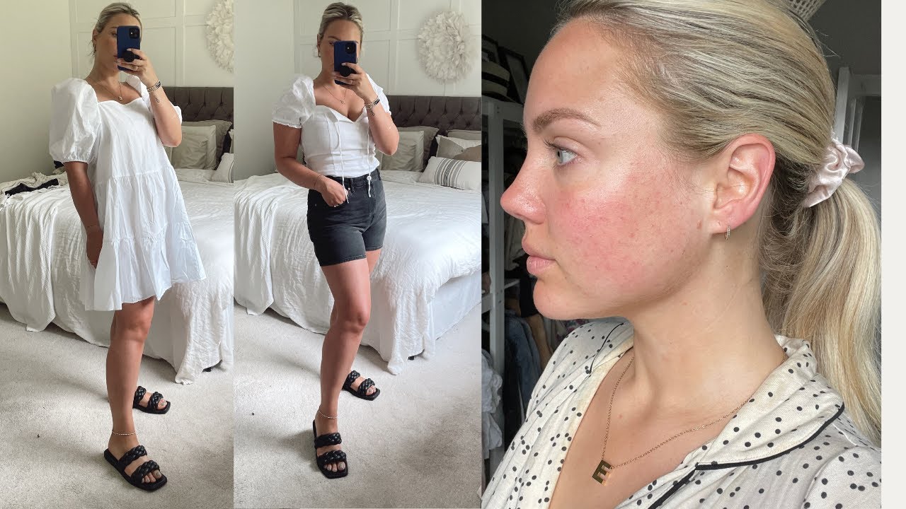 H&M Try on Haul & Skin Update | Elanna Pecherle 2021