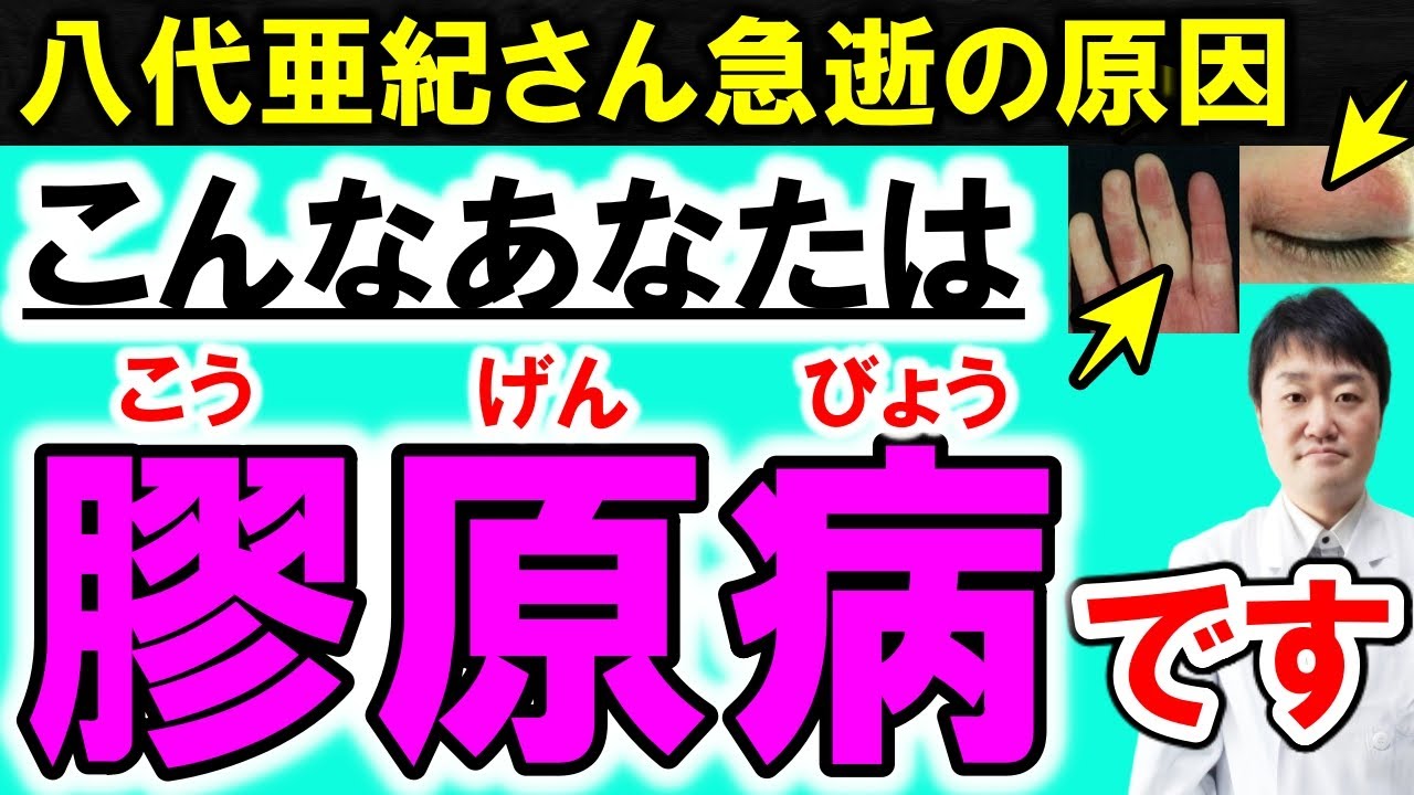 【放置禁止】知らないと後悔する膠原病が起こす10の体の変化とサイン　八代亜紀さんの急逝の理由や初期症状とは？　医師が詳しく解説