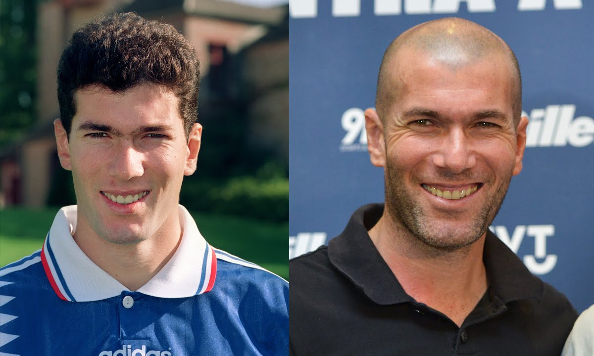 Can You Guess The Bald Footballers From When They Had Hair?