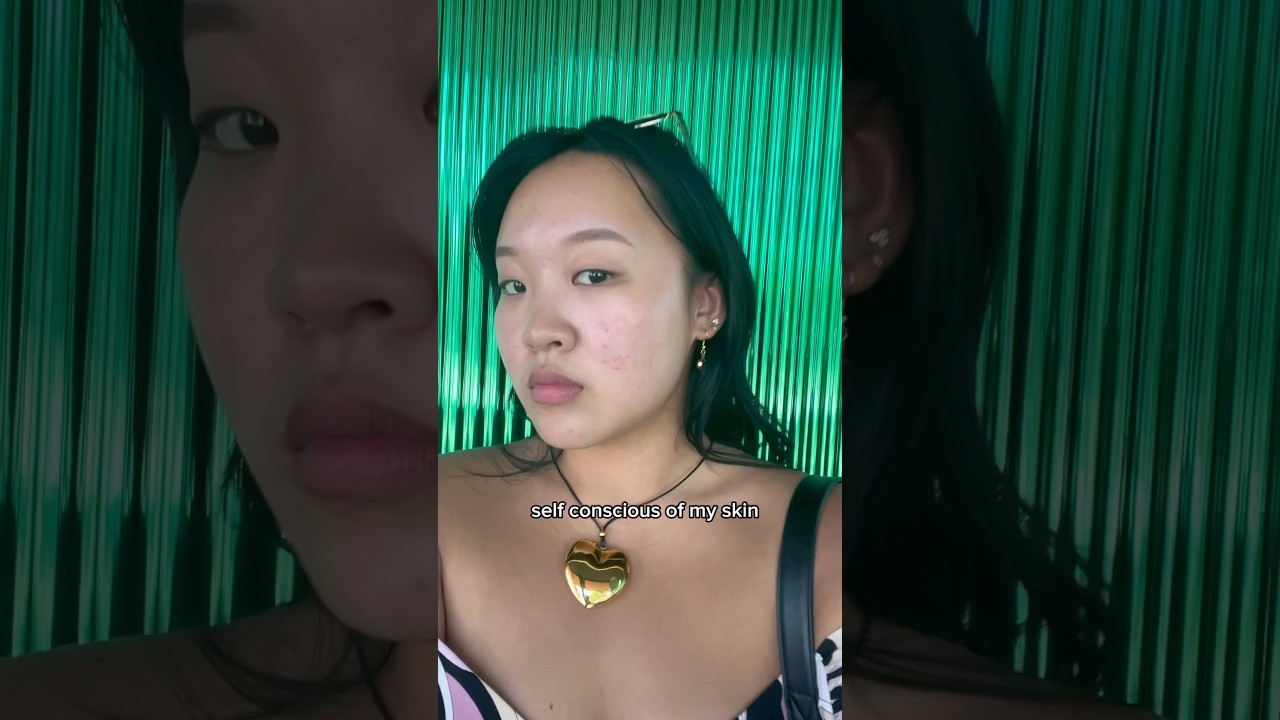 FIXING my BAD skin 😭 #skin #acnescars