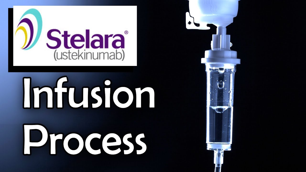 Stelara Infusion Process: Ulcerative Colitis Treatment